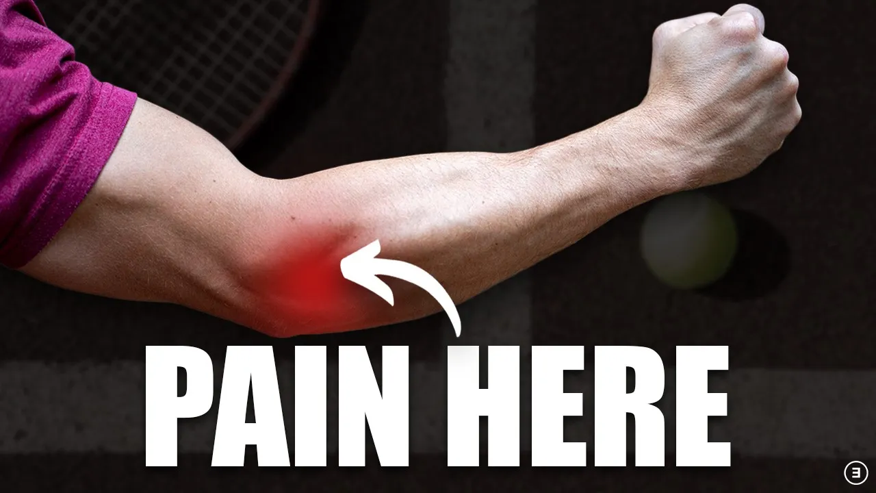 Anatomy of tennis elbow showing the lateral epicondyle and forearm extensor muscles