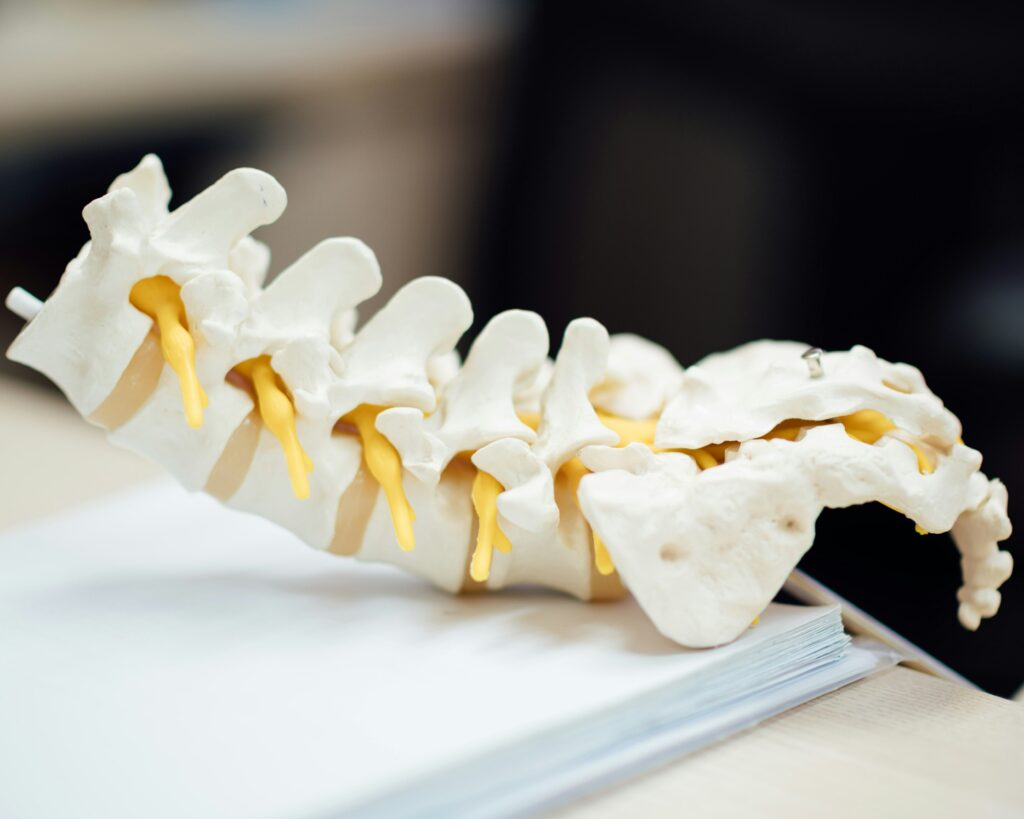 Slipped Disc Osteopathy